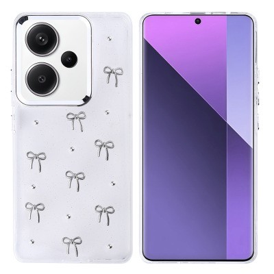 Xiaomi Redmi Note 13 Pro Plus 5G Case Airbag Design Glitter Transparent Zore Kutup Cover - 3