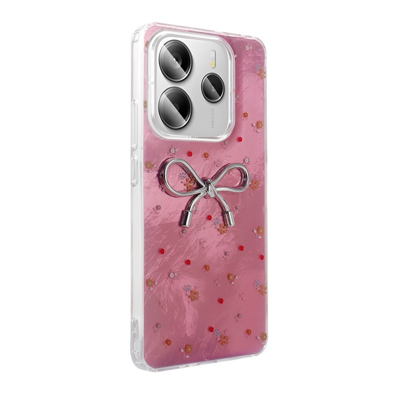Xiaomi Redmi Note 14 4G Case Camera Protection Figured Zore Ponti Silicone Cover - 8