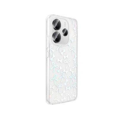 Xiaomi Redmi Note 14 4G Case Transparent Figured Zore Folk Hard Cover - 10