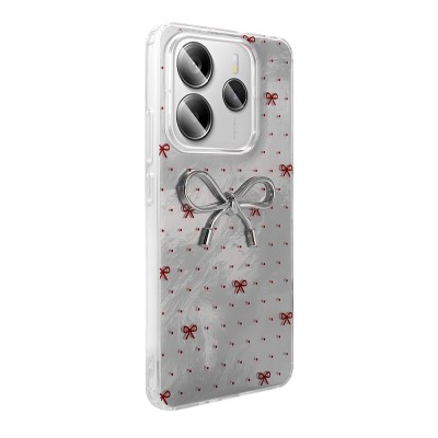 Xiaomi Redmi Note 14 5G Case Camera Protection Figured Zore Ponti Silicone Cover - 12