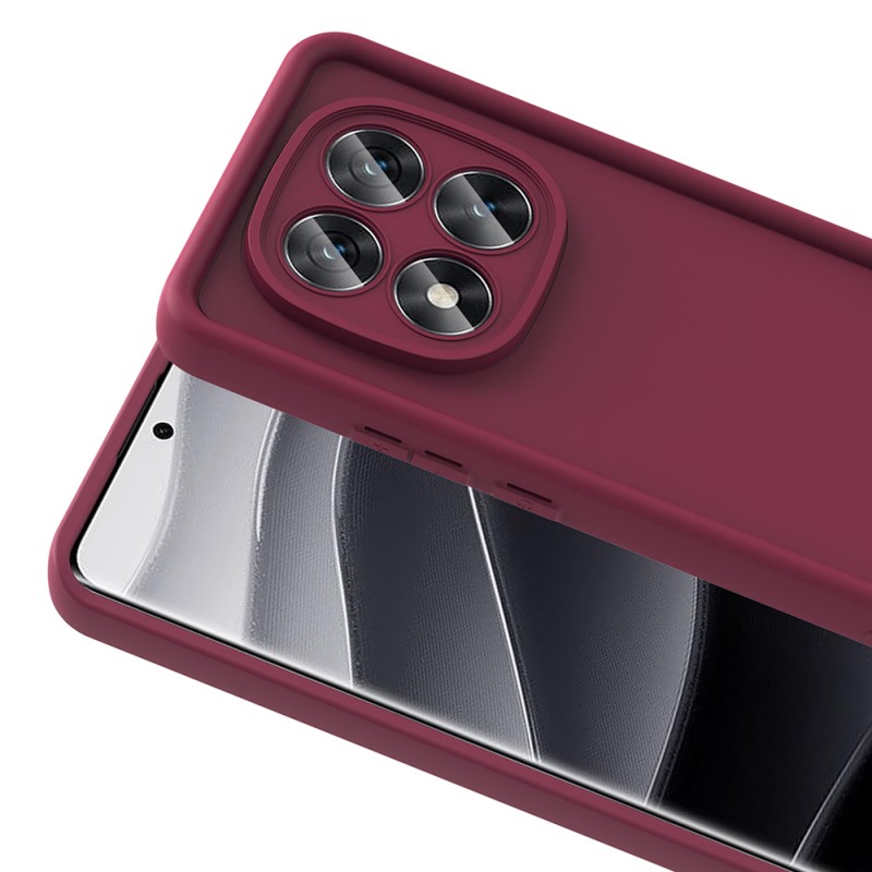 Xiaomi Redmi Note 14 Pro 5G Case Camera Protection Zore Ananas Cover - 11