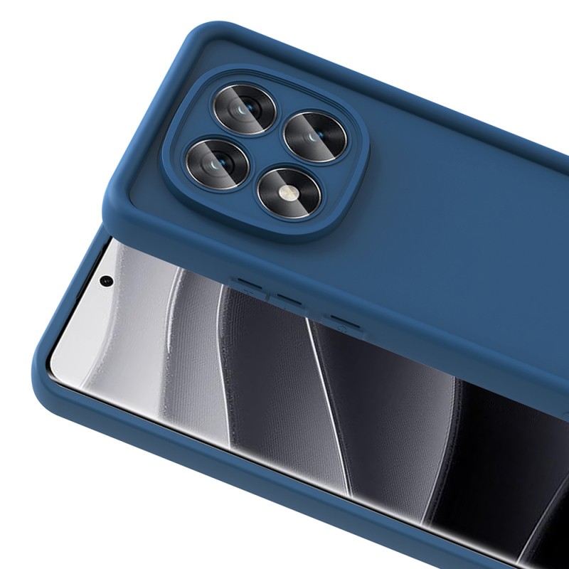 Xiaomi Redmi Note 14 Pro Plus Case Camera Protection Zore Ananas Cover - 13