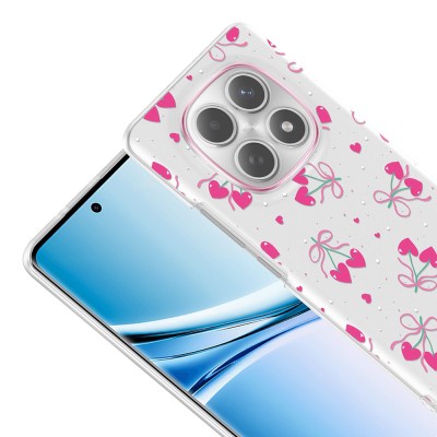 Xiaomi Redmi Note 15 4G Case with Camera Protection, Patterned Zore Clip Cover - 10