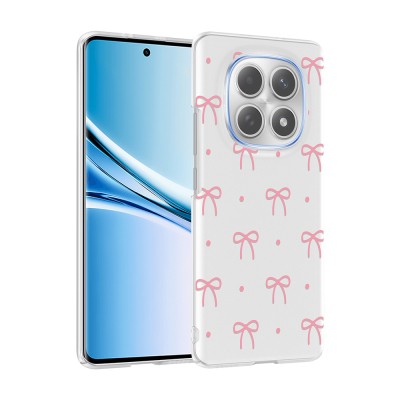 Xiaomi Redmi Note 15 4G Case with Camera Protection, Patterned Zore Clip Cover - 3