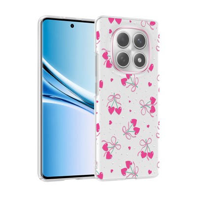 Xiaomi Redmi Note 15 5G Case with Camera Protection, Patterned Zore Clip Cover - 3