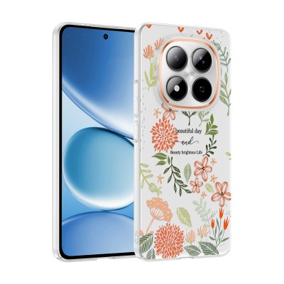 Xiaomi Redmi Note 15 Pro 4G Case with Camera Protection, Patterned Zore Clip Cover - 4