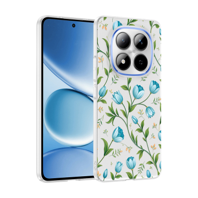 Xiaomi Redmi Note 15 Pro 4G Kılıf Kamera Korumalı Desenli Zore Klip Kapak - Zore
