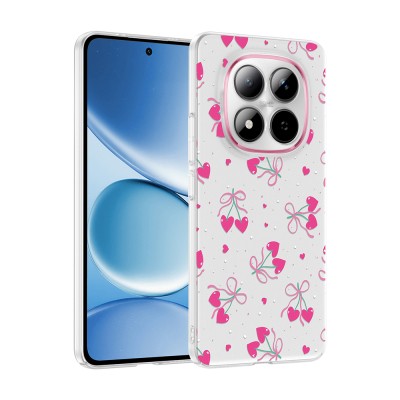 Xiaomi Redmi Note 15 Pro 4G Kılıf Kamera Korumalı Desenli Zore Klip Kapak - 3