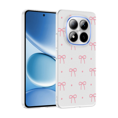 Xiaomi Redmi Note 15 Pro Plus Kılıf Kamera Korumalı Desenli Zore Klip Kapak - Zore